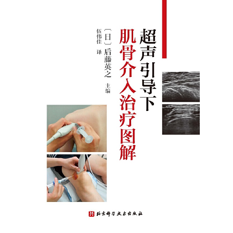 超声引导下肌骨介入治疗图解-图0