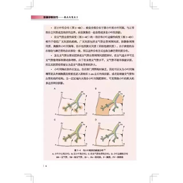 当当网正版包邮脑卒中影像诊断技巧图解 影像诊断 读片技巧 影像解剖 影像读片技巧丛书北京科学技术出版社影像医学 9787571424657 - 图2