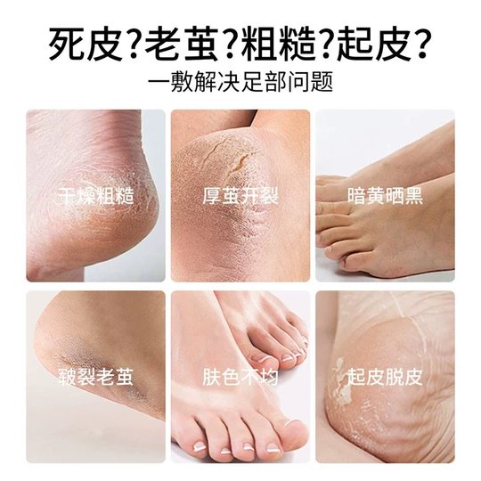 Baby Foot男士足膜专为男士厚角质设计 60分钟护理 双脚光滑细腻