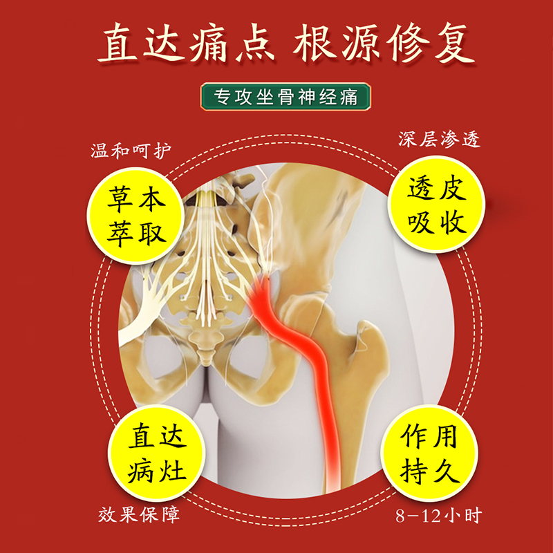 坐骨神经疼痛膏喷剂腰疼腿疼屁股疼通络膏药专用治腰椎盘压迫麻木-图0