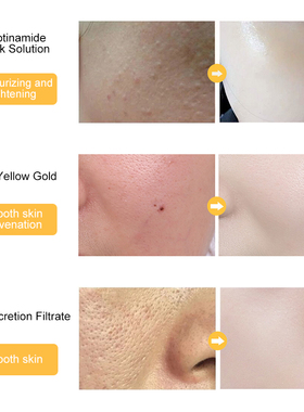 24k Gold Face Serum Hyaluronic Acid Serum Moisturizer 100ML