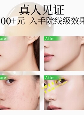 U牌自愈系还原精华液抗皱紧致保湿精华正品轻盈收缩毛孔水润养肤
