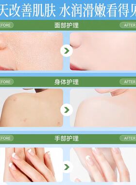 原装山羊澳洲绵羊油面霜gm澳芝曼ve晚霜全身补水保湿身体乳护手霜