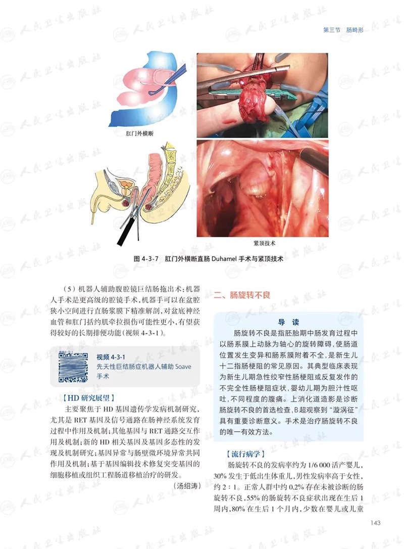 正版现货 儿童消化病学 附视频 江米足龚四堂儿童消化病临床实用诊治思路及经验儿科医生临床工具书 人民卫生出版社9787117352284 - 图3