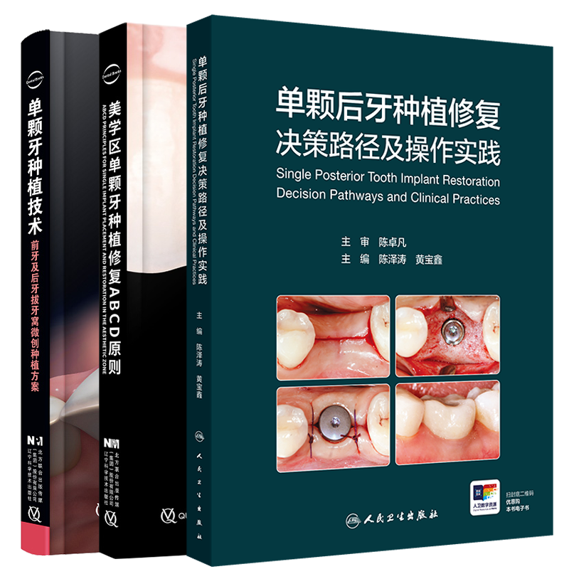 任选 单颗后牙种植修复决策路径及操作实践/美学区单颗牙种植修复ABCD原则/单颗牙种植技术前牙及后牙拔牙窝微创种植方案陈泽涛等