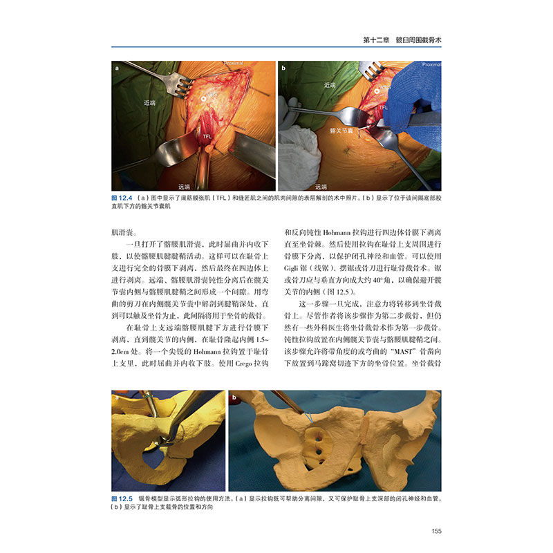 全新正版髋关节发育不良的认识与治疗 孙永强 叶晔主译髋关节发育不良的病因学 遗传和环境因素 辽宁科学技术出版社9787559117175 - 图3