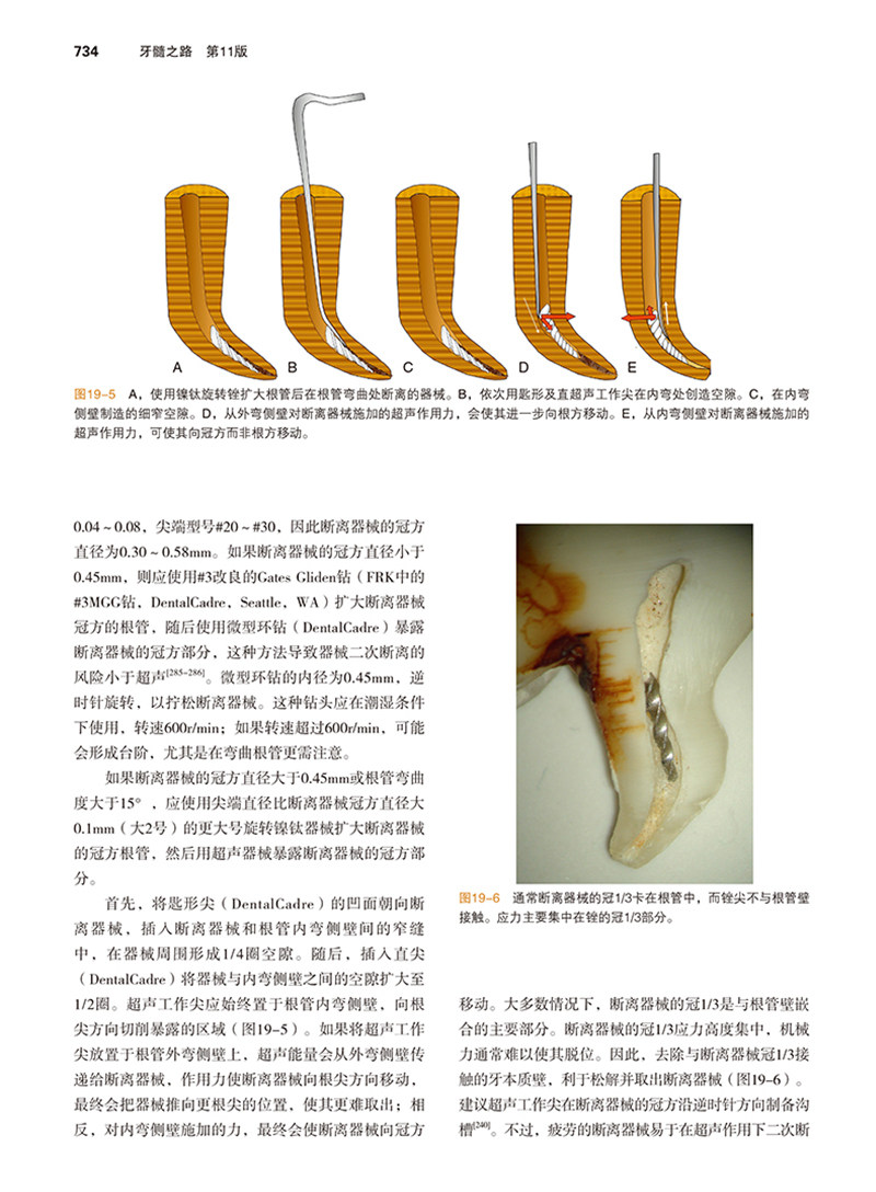 牙髓之路 第十一版第11版 牙体牙髓病学临床牙髓再生技术口腔书籍医学类专业书籍牙科牙髓治疗根管治疗图谱辽宁科学技术出版社