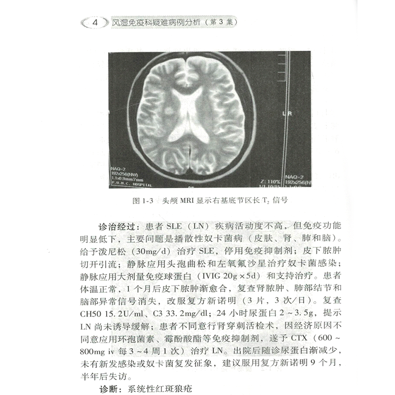 正版现货 共4册北京协和医院风湿免疫科疑难病诊断病例分析—协和医生临床思维例释第1234集1-4集一二三四中国协和医科大学出版社 - 图3