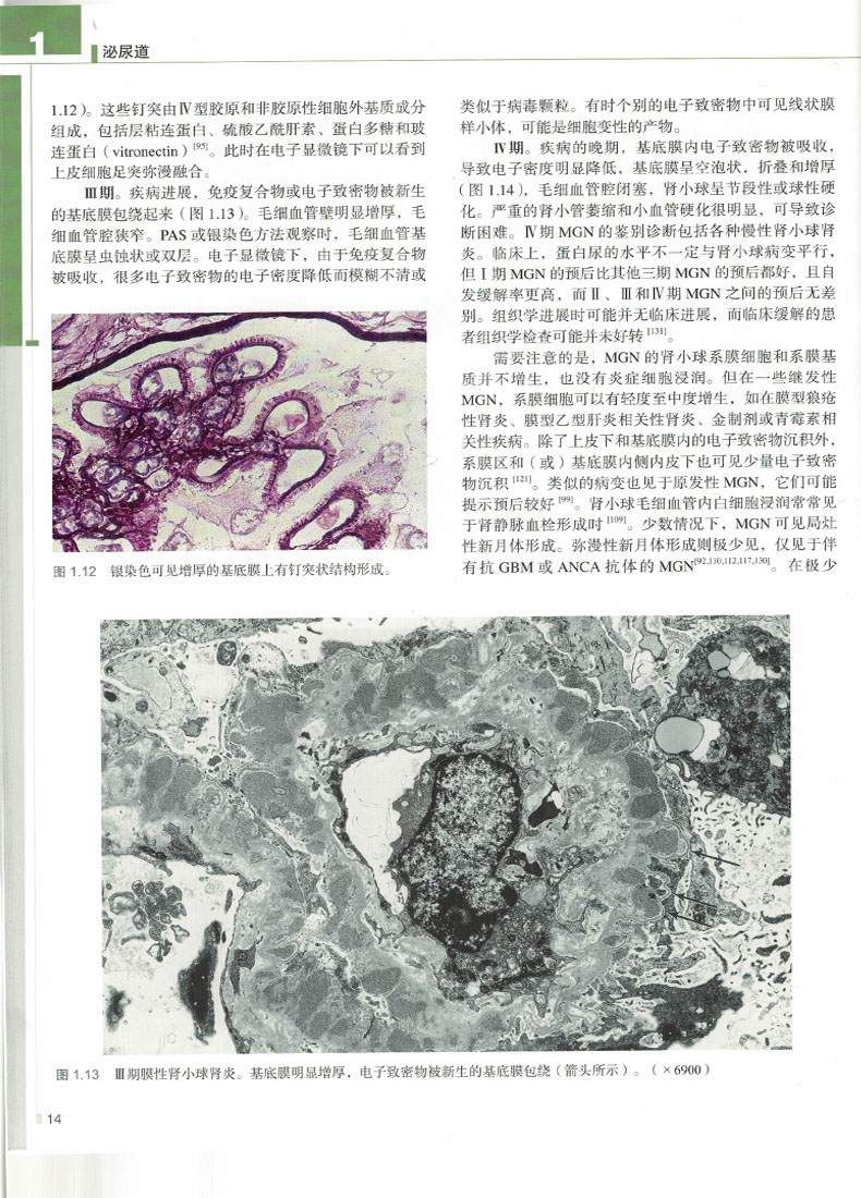 正版现货罗塞-阿克曼外科病理学第10版泌尿道与男性生殖系统分册北京大学医学出版社-图2