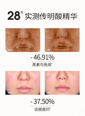 SOUNDER ONE三蛋丸5%传明酸精华脂质体包裹氨甲环酸淡印均匀肤色