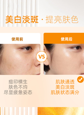 加芬左旋原液vc美白淡斑亮肤礼盒