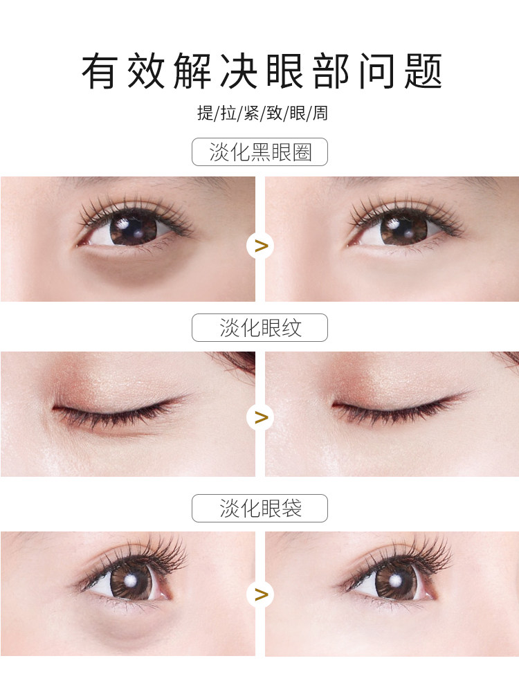神器提拉紧致去除黑眼圈克星眼霜 爱肤宜妮希娅眼霜