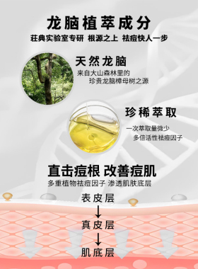 荘典龙脑祛痘针对性解决各种痘