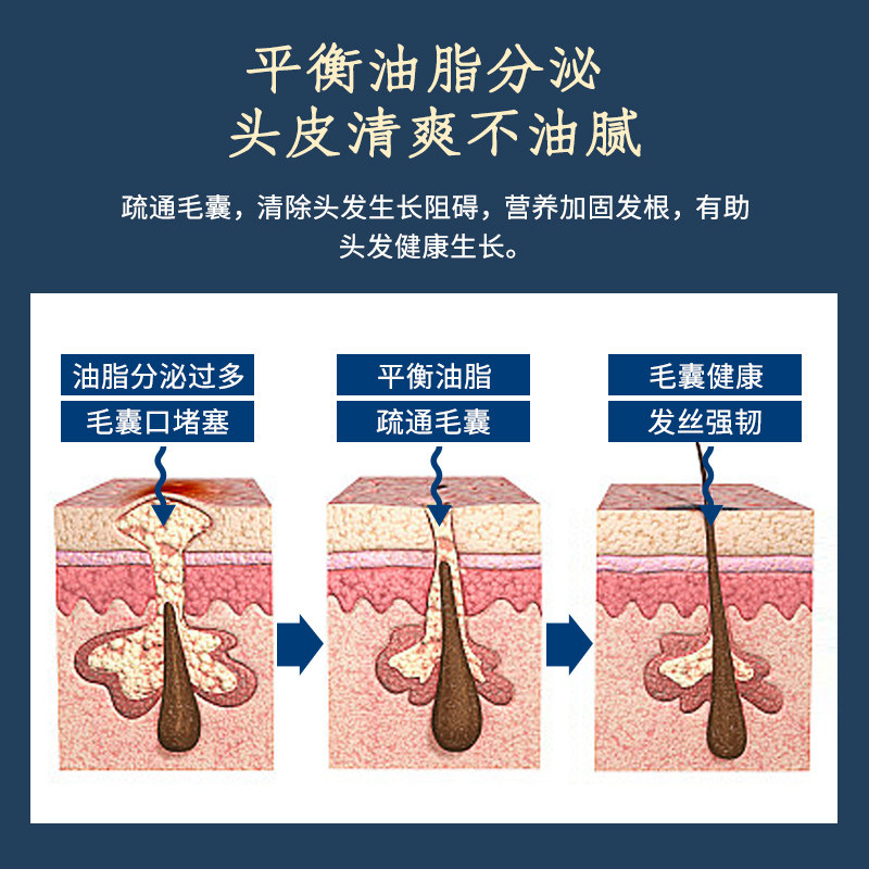 草方防脱男女士去痒育发液洗发露 草方洗发水