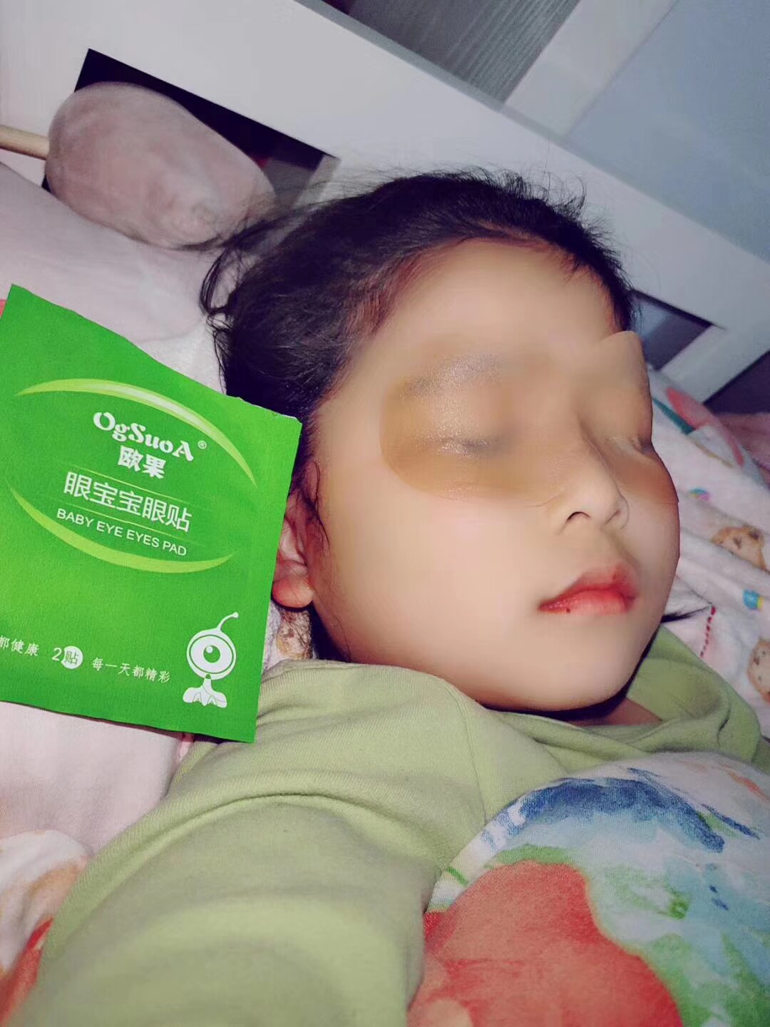 欧果眼宝宝眼贴青少年近视眼贴膜 微微盈超市 服务大家眼贴