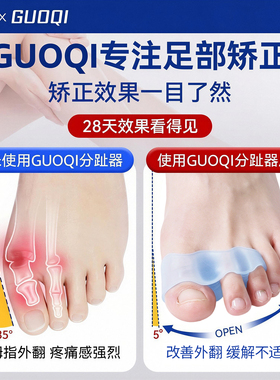 日本硅胶脚趾矫正器男女士拇指外翻三指分趾神器大母趾矫正可穿鞋
