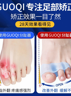 德国GUOQI拇指外翻脚趾矫正器硅胶分趾器大拇脚趾分离器可穿鞋套