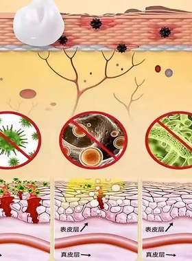 拔毒断痒抑菌膏 云南本草皮肤瘙痒乳膏百毒膏顽固青草膏全身外用