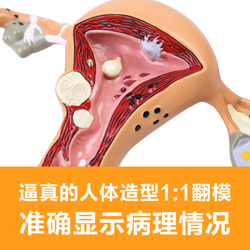 人体子宫模型生殖科妇科医用演示模型 女性子宫阴道模型病理子宫 - 图1