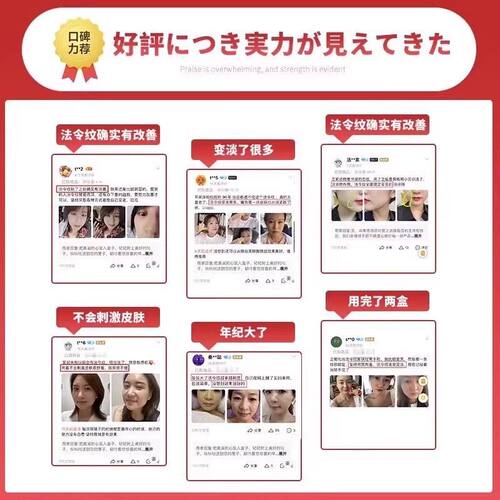 【川字纹贴】水滴抗皱纹贴法令纹神器去除眉间纹鱼尾睡觉抗皱 - 图2