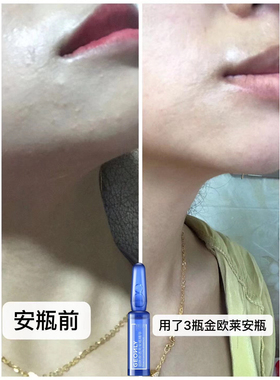 安瓶原液精华烟酰胺收缩毛孔修复