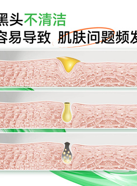 李医生去黑头导出精华液粉刺毛孔