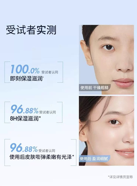 稚优泉官方正品深海水母精华补水面膜20片补水精华保湿控油面膜