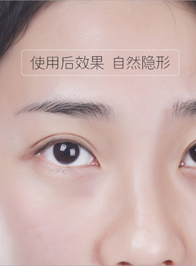 玛莉安正品卷筒蕾丝包邮双眼皮贴
