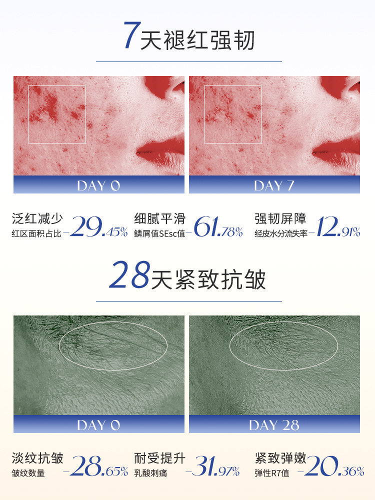 ORANOT柔酸肌底液调理焕肤提亮温和刷酸改善闭口收缩毛孔精华液01 - 图2