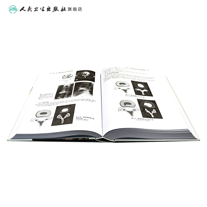 腰椎间盘突出症 第五版胡有谷陈伯华实用外科学疼痛科诊疗手术介入术后康复颈腰关节及注射疗法脊柱病因治疗骨科腰痛人卫医学书籍
