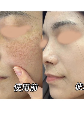 巨美特奢润赋颜靓肤霜提亮紧致