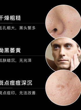 梵贞venzen控油补水保湿面部护理