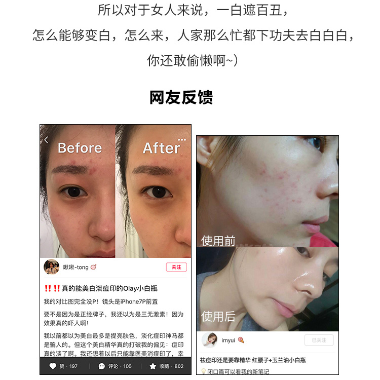 olay玉兰油小白瓶水感透白光塑淡斑精华液露小绿瓶烟酰胺保湿滴管