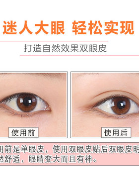 蕾丝双眼皮贴女双眼皮橄榄型无痕网纱影楼专用免胶水男肿泡防眼垂