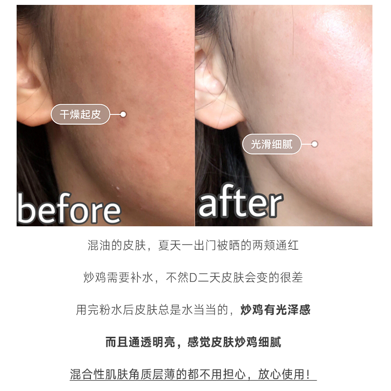 兰蔻粉水 女保湿舒缓补水玫瑰爽肤柔肤干皮大粉水 400ml 法国 lancome 兰蔻粉水 女保湿舒缓补水玫瑰爽肤柔肤干皮大粉水 400ml 法国 lancome