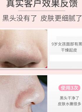 黑头粉刺鼻贴收缩毛孔男士