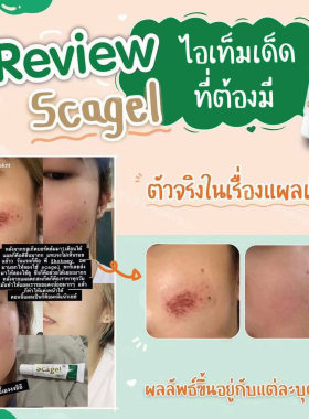 泰国进口Cybele丝贝兰Scagel祛疤凝胶温和淡化各类疤痕预防新疤痕