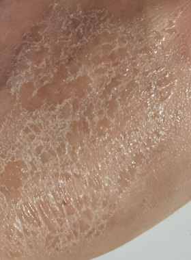 胶影视脸部妆容皮肤干裂特效化妆