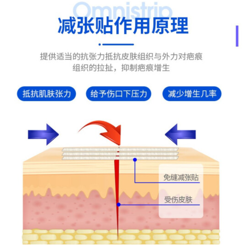 德国原装正品Omnistrip免缝胶带伤口疤痕愈合剖腹产减张贴超大号 - 图1