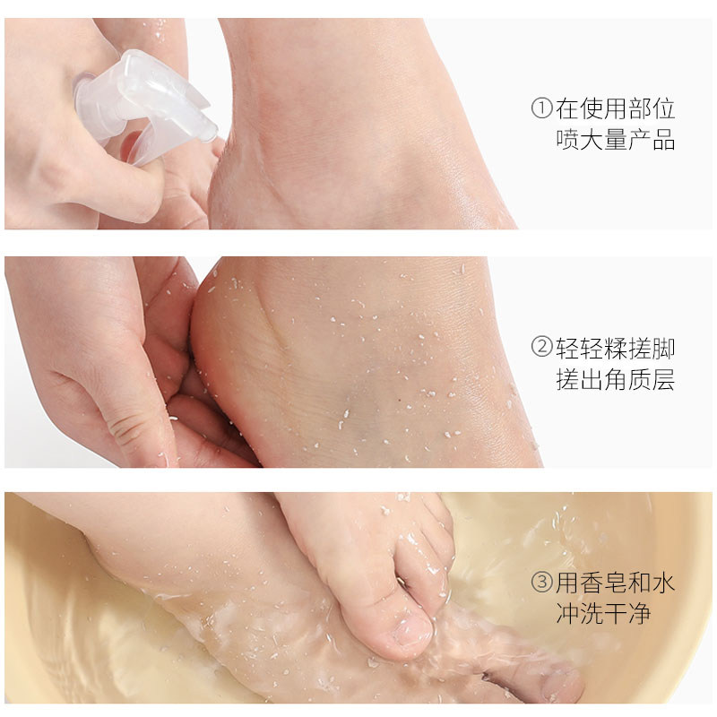 伊诗兰顿足部去角质喷雾手肘护理女 伊诗兰顿足部磨砂
