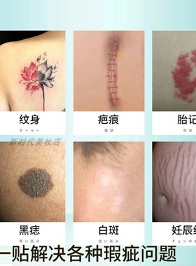 纹身疤痕胎记遮盖贴遮瑕防水隐形