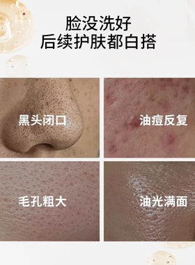 芈蕊驻漾小气泡洁面露