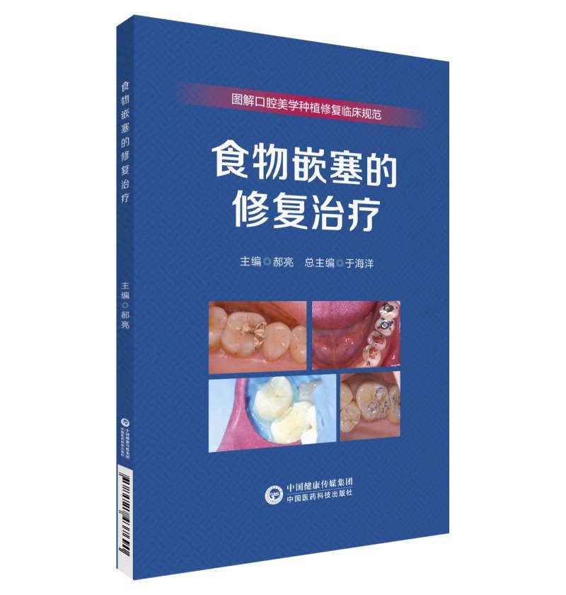 食物嵌塞的修复治疗 图解口腔美学种植修复临床规范 于海洋主编供各级医疗机构口腔专业参考使用 中国医药科技出版社9787521437690 - 图1