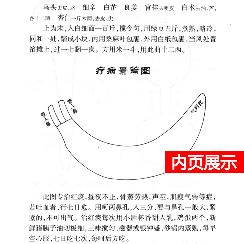 正版精装 寿世保元 中医古籍整理丛书重刊明龚廷撰著鲁兆麟校注内府之珍藏方外异人之秘传中医临床各科效方人民卫生出版社古籍子部 - 图2