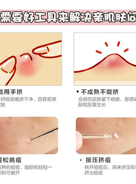 挑痘痘美容院专用去闭口化妆工具
