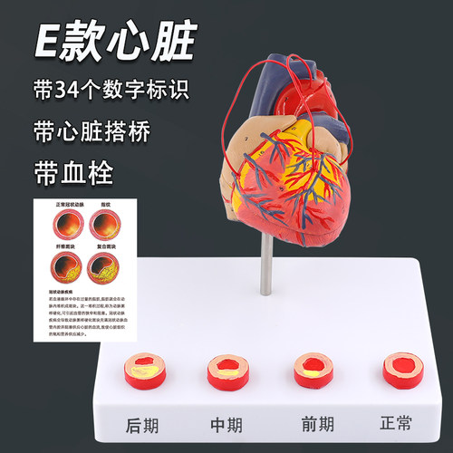1:1人体心脏解剖模型 B超彩超可拆卸自然大心脏医学教学模型 - 图1