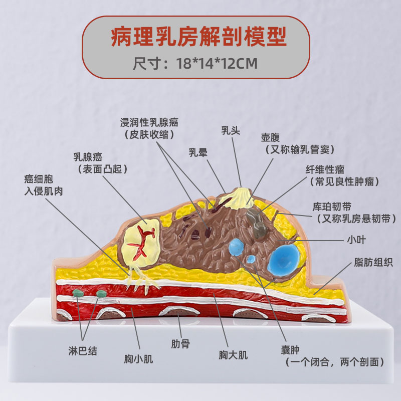 哺乳期乳房模型胸部解剖乳房结构造乳房乳腺病变模型催乳师教具 - 图0