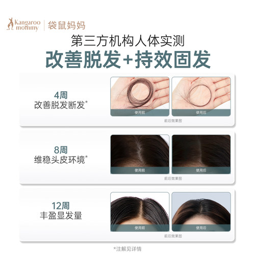 袋鼠妈妈防脱洗发水控油蓬松固发去屑专用洗护套装防脱洗发露 - 图2