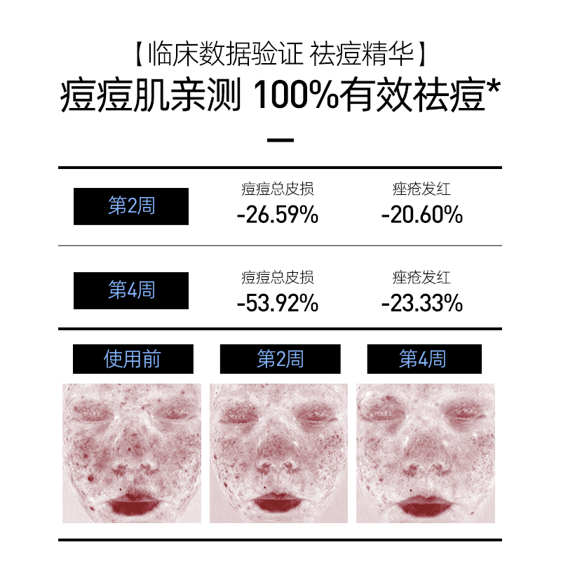 莱仕皮傲宁祛痘精华液去闭口粉刺痘肌舒缓修护淡化痘印褪红无酸-图0