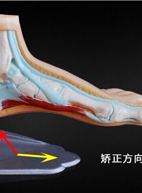 儿童半码后跟矫正鞋垫